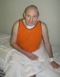 Beketov in the hospital after being brutally beaten. (CPJ)