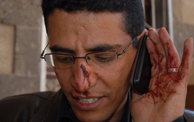 BBC Arabic correspondent Abdullah Ghorab, after the attack on Wednesday. (AFP/Gamal Noman)