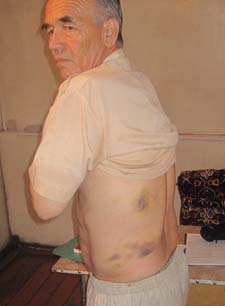 Askarov, shown here on June 23, 2010, was badly beaten while in police custody. (Nurbek Toktakunov)