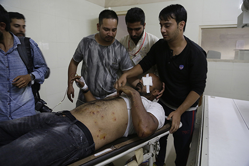 Pellet gun wounds can be seen on the body of Zuhaib Maqbool. The freelance photographer may permanently lose the sight in one eye after being fired on while covering unrest. (AP/Mukhtar Khan)