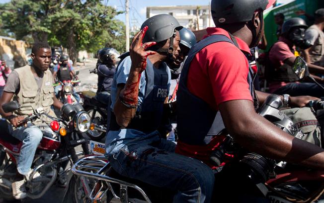 Un journaliste de Reuters, Robenson Sanon, soulève son bras, couvert de sang, après avoir été touché par balle lorsqu'il documentait les affrontements entre la police nationale et les manifestants près du palais présidentiel à Port-au-Prince en Haïti le 13 février 2019. (God Nalio Chery / AP)