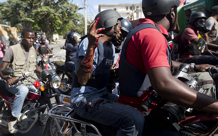 Reuters journalist Robenson Sanon holds up his blood covered arm, after he was shot while documenting clashes between national police and protesters near the presidential palace in Port-au-Prince, Haiti, on February 13, 2019. (Dieu Nalio Chery/AP)