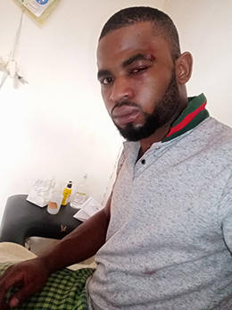 Paul Chouta was treated for stab wounds and bruising after being attacked. (Cameroon Web)