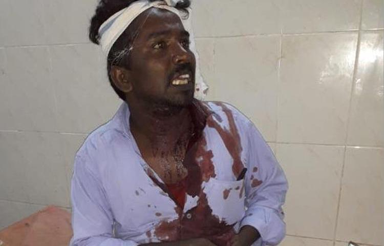 Journalist G. Muthuvel is seen following the attack against him on June 19, 2019. (Image via The News Minute, used with permission)