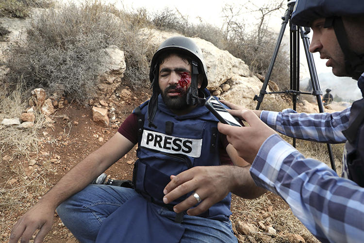 Palestinian photographer Moath Amarneh is seen after being hit with shrapnel from a rubber bullet fired by Israeli security forces in Surif, the West Bank, on November 15, 2019. (AFP/Hazem Bader)