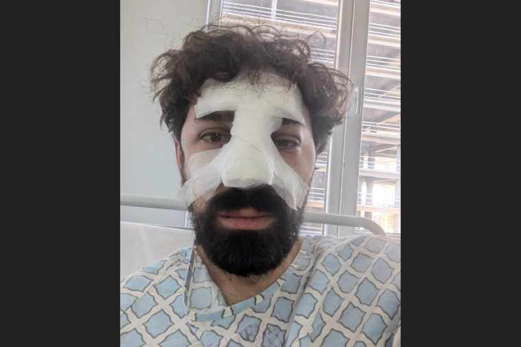 Publika reporter Aleksandre Keshelashvili suffered a broken nose following an assault by police officers before he was detained at a Tbilisi police station, among other reported incidents of journalists being assaulted while covering pro-European Union demonstrations. (Photo: Courtesy of Publika)