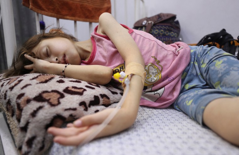 A Palestinian girl Jana Ayad, who is malnourished, according to medics, in a hospital in Gaza City in July 2025.